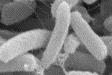 Description: E. coli