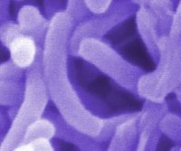 Description: Vibrio cholerae